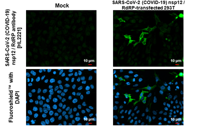 Anti-SARS-CoV-2 (COVID-19) nsp12 / RdRP antibody [HL2221] used in Immunocytochemistry/ Immunofluorescence (ICC/IF). GTX638225